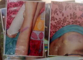 মনোহরগঞ্জে জমি সংক্রান্ত বিরোধে প্রতিবেশীদের বিরুদ্ধে ভূমি দখল ও মারধরের অভিযোগ ‎