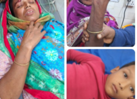 সাপাহারে শিয়ালের কামড়ে নারী-শিশুসহ আহত ৩